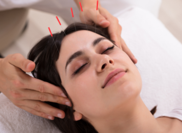 Discover the Benefits of Acupuncture: Woman Receiving Treatment