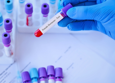 Doctor holding a test blood sample tube with "Female Hormone Test" label, with medical test tubes in the background. Copy space for text. Monitoring Progesterone Levels in IVF is crucial for successful fertility treatment.