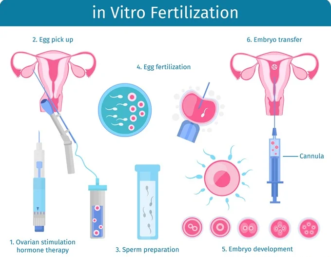 IVF-process-infographic-ectorPot-_thumb-copy